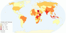 Children with Trachoma by Country
